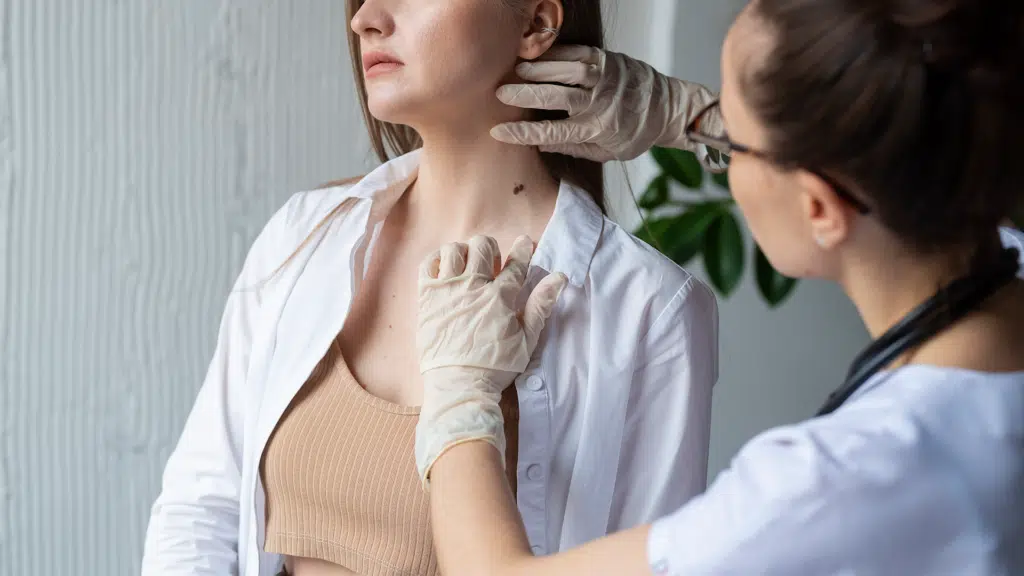 პაპილომა ვირუსის (HPV) ინფექციის საილუსტრაციო სურათი